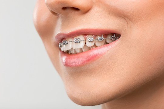 why its done orthodontics applecross