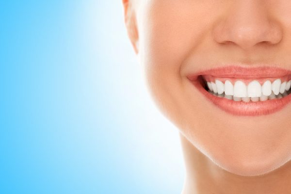 dental veneers applecross