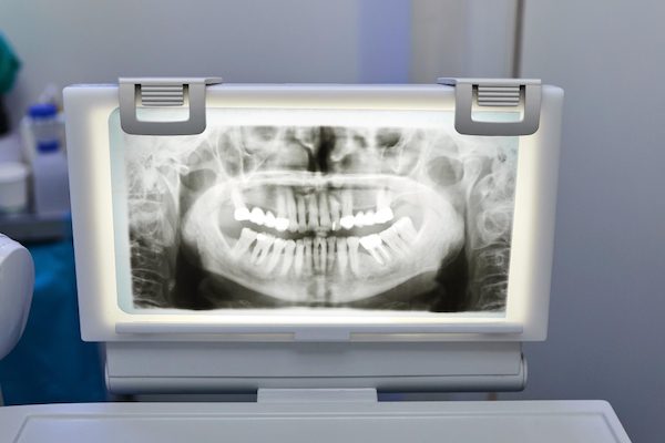 dental x-rays applecross