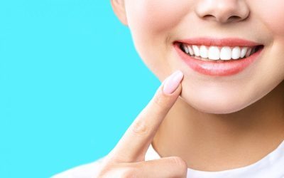 How to Keep Your Smile Bright After Whitening Your Teeth
