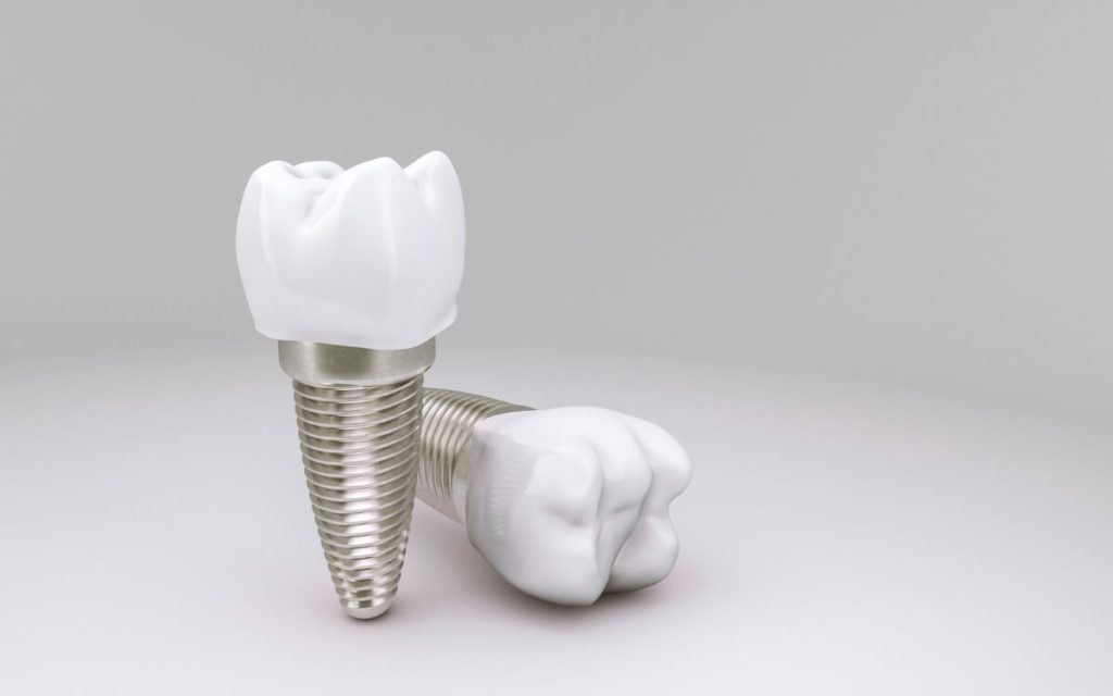 understanding the long-term benefits of dental implants