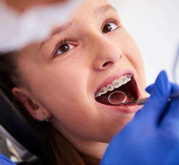 dental braces applecross