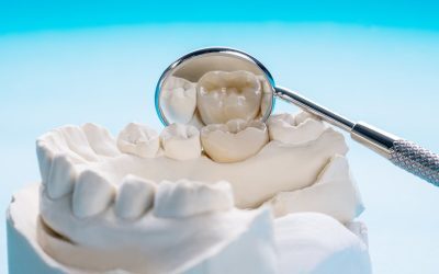 Dental Crowns vs. Bridges: Which One Fits Your Smile?