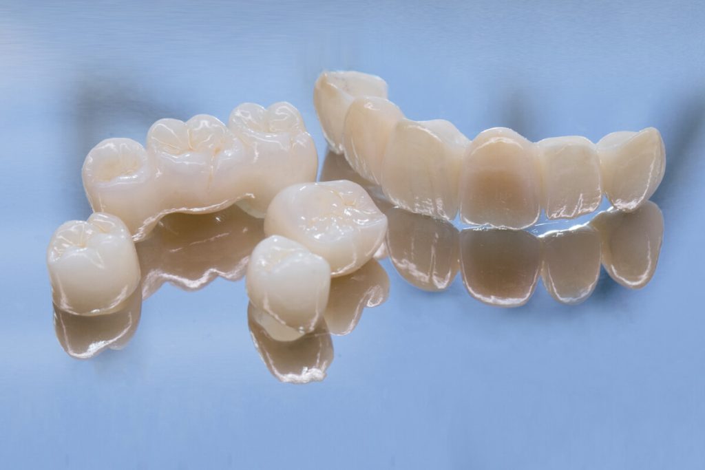 common problems with dental bridges and how to handle them