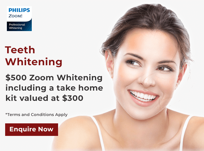 zoom whitening offer banner dentist applecross